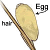 Illustration of head lice egg on a hair shaft.